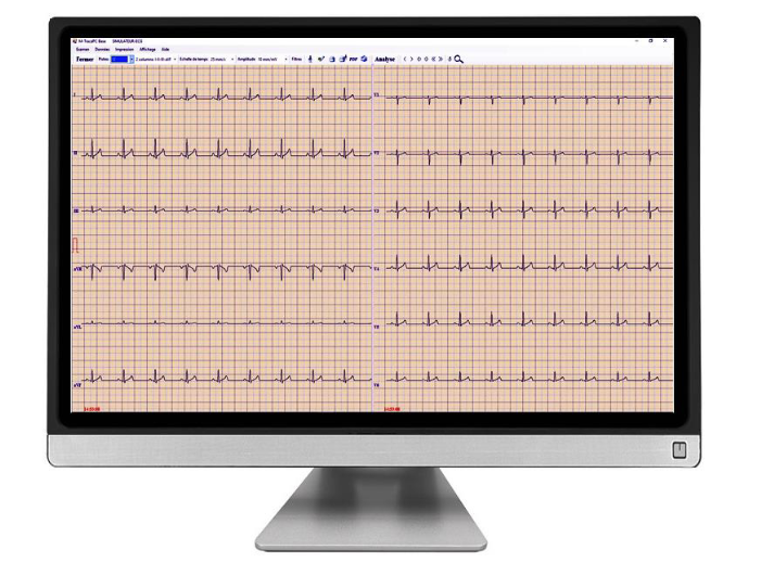 ECG - PC EOLYS
