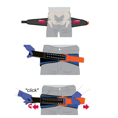Ceinture de contention pelvienne SAM SLING