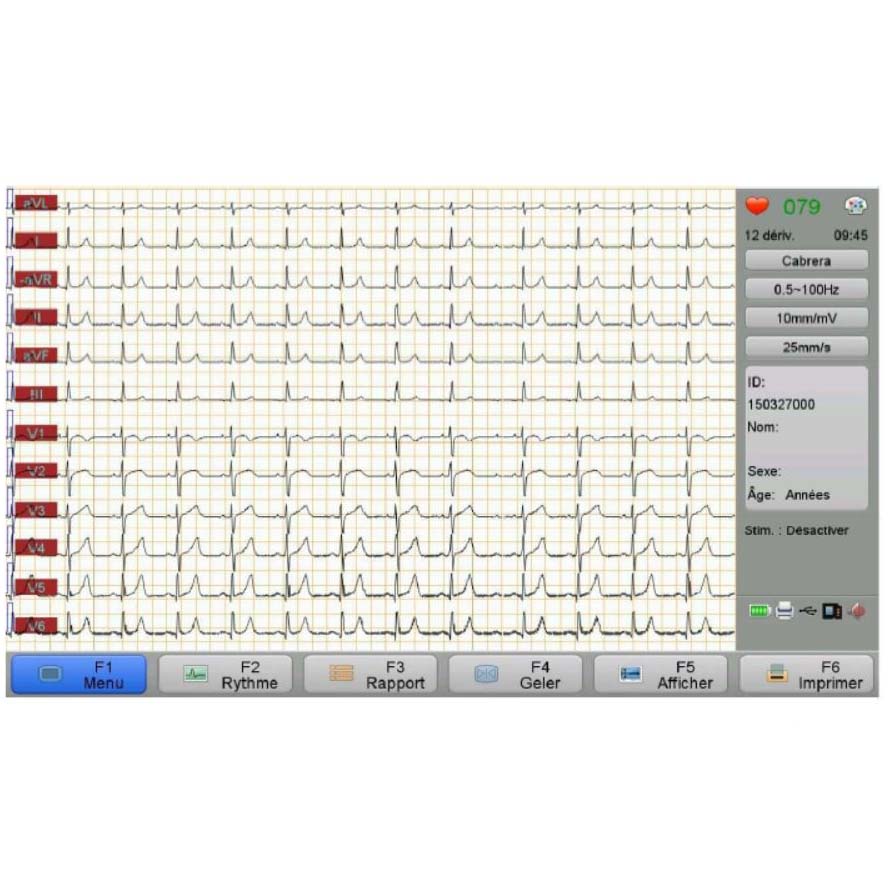 ECG 12 pistes - IE12A