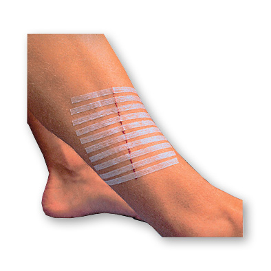 Sutures adhésives stériles 3m™ Steri-strip™