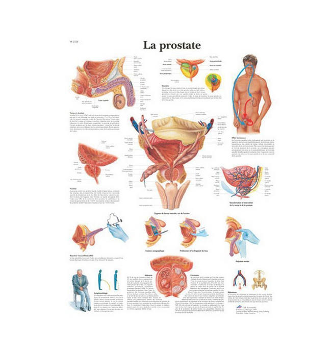 Planche anatomique la Prostate